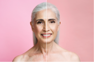 stem-cells-reversal-of-aging